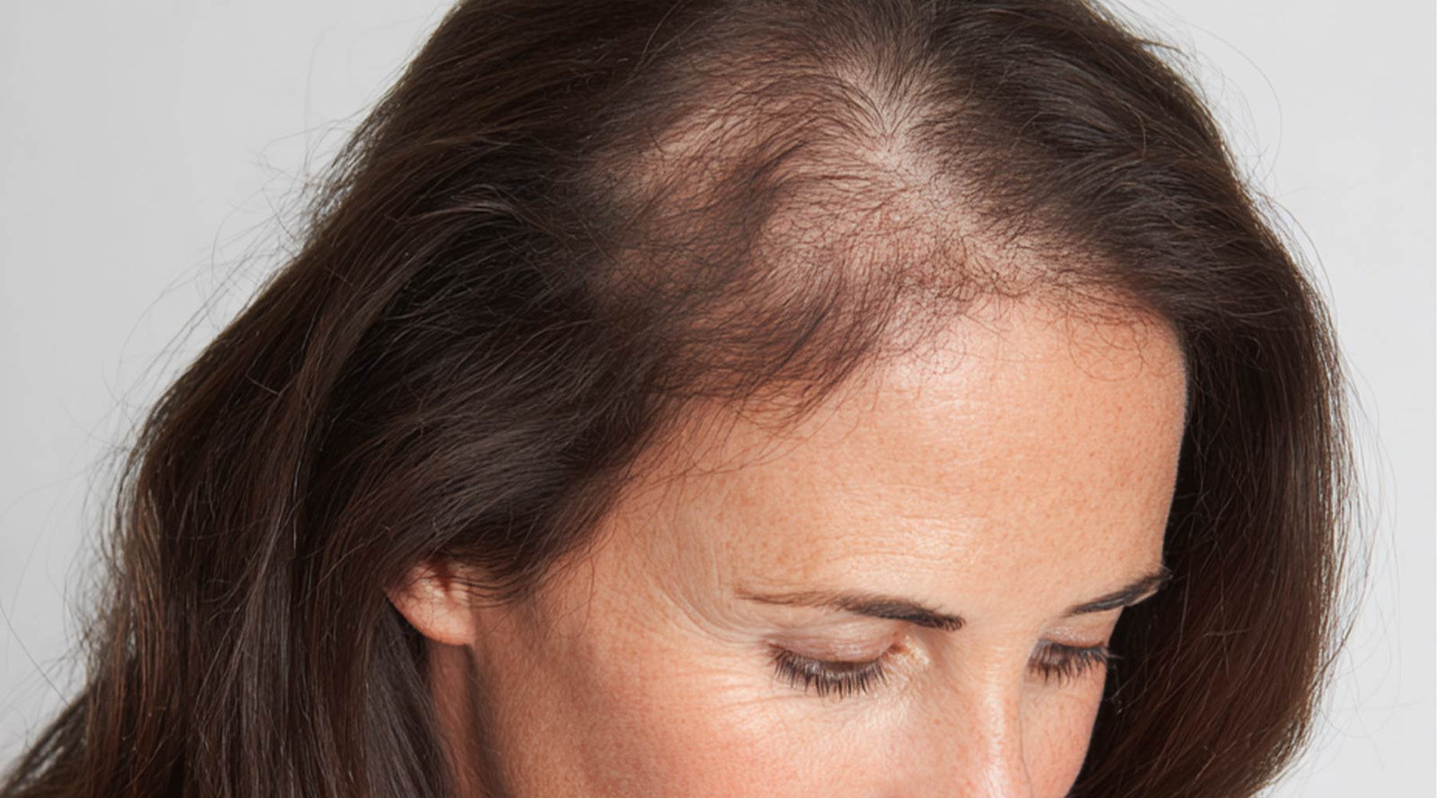 Woman with brown hair and a visibly thinning part, looking down