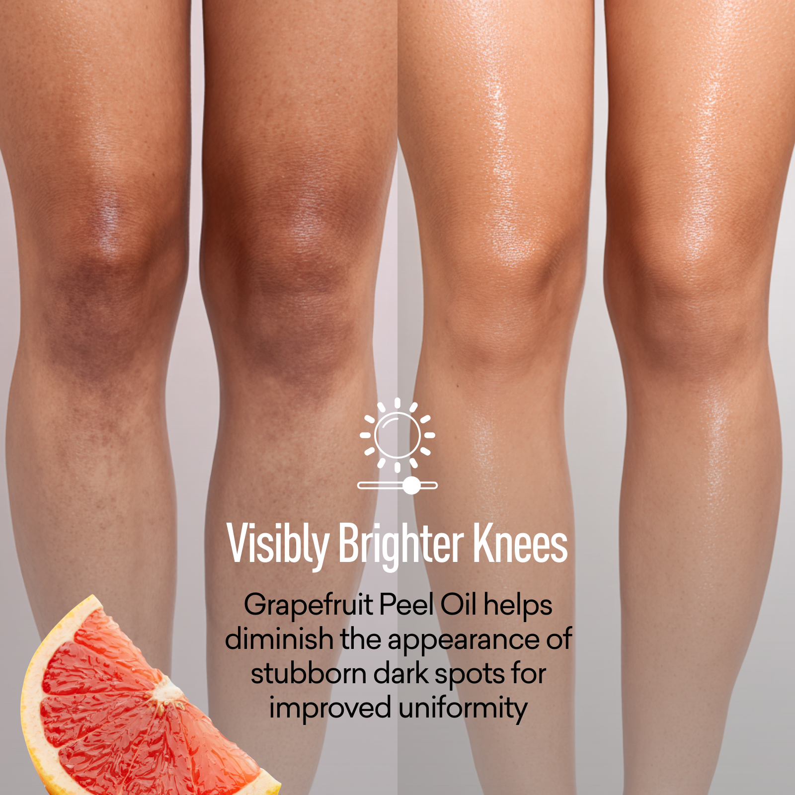 Even Skin Tone Treatment