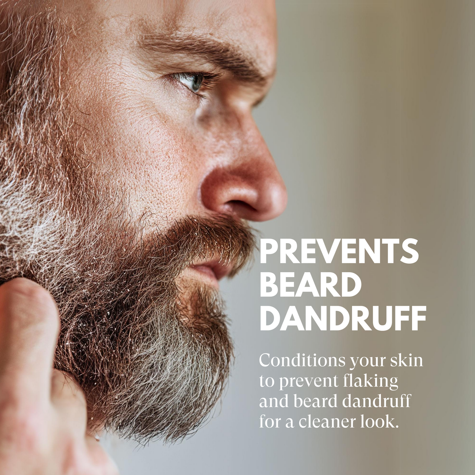 Man with a beard and text about preventing beard dandruff and flaking.