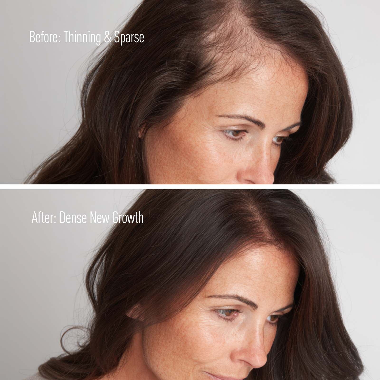 Grow New Hair Treatment | Scalp Problems