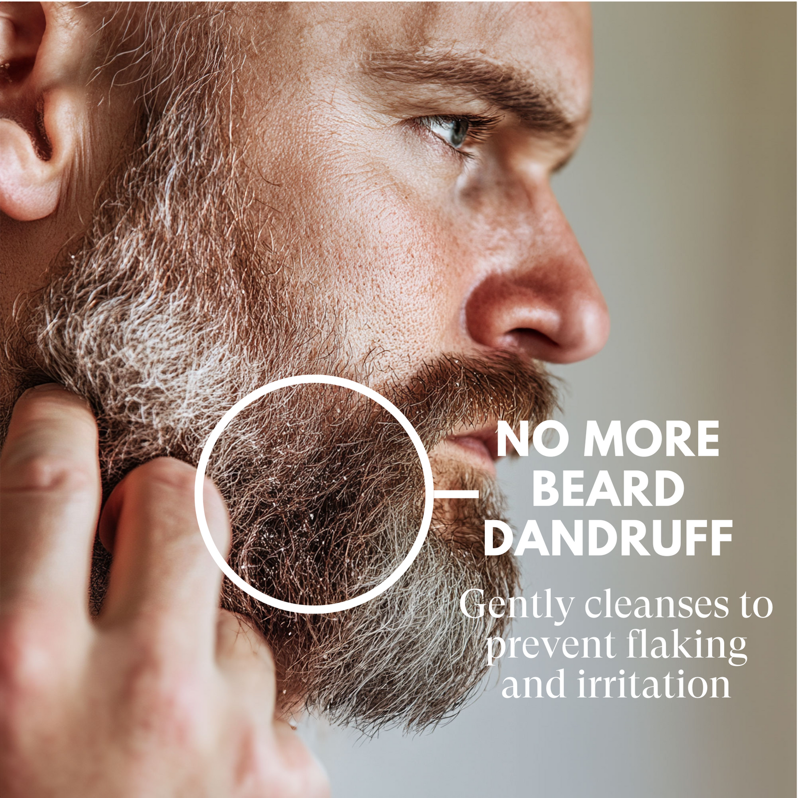 Man with beard and dandruff, with text 'No More Beard Dandruff' and product description.