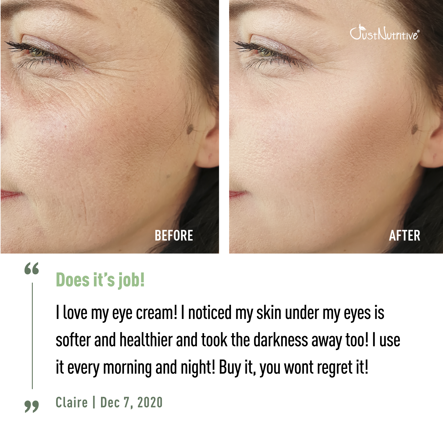Before and after comparison of eye cream on a woman's face with a visible improvement.