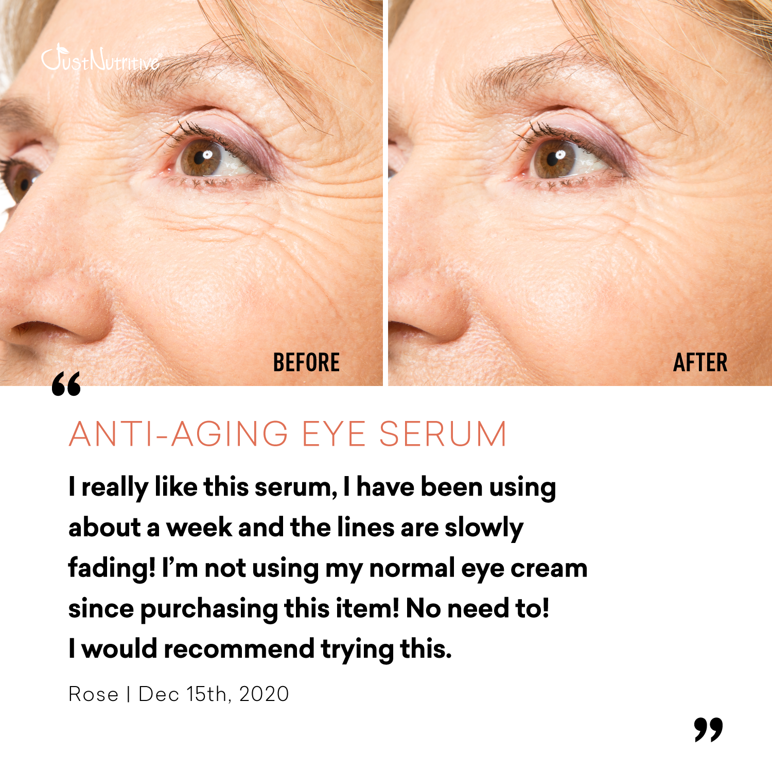 Before and after comparison of a woman's eyes with anti-aging eye serum, featuring a user review.