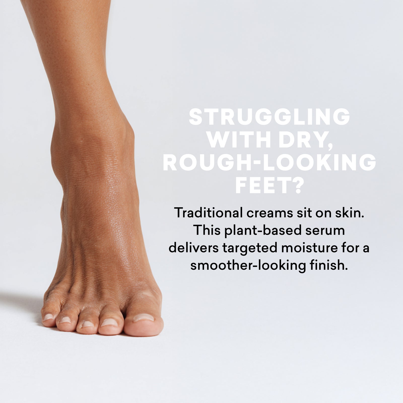 Foot with dry, rough-looking skin on a light gray background, featuring text about a plant-based serum for foot care.