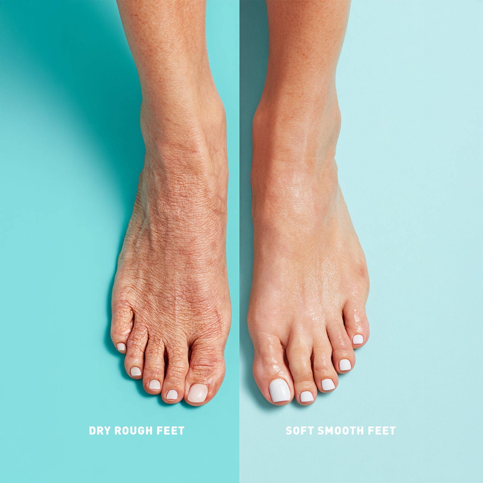 Comparison of dry, rough feet on the left and soft, smooth feet on the right against a light blue background.