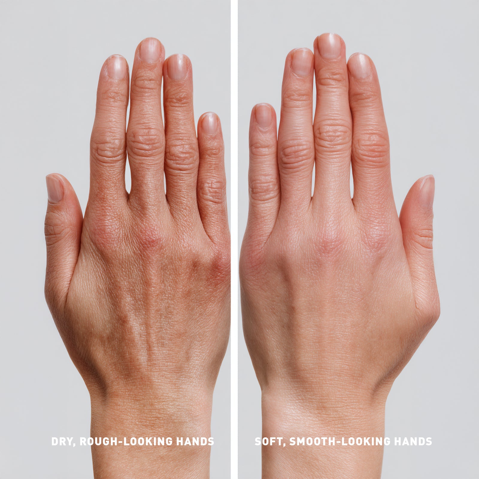 Comparison of dry, rough-looking hands versus soft, smooth-looking hands on a plain background.