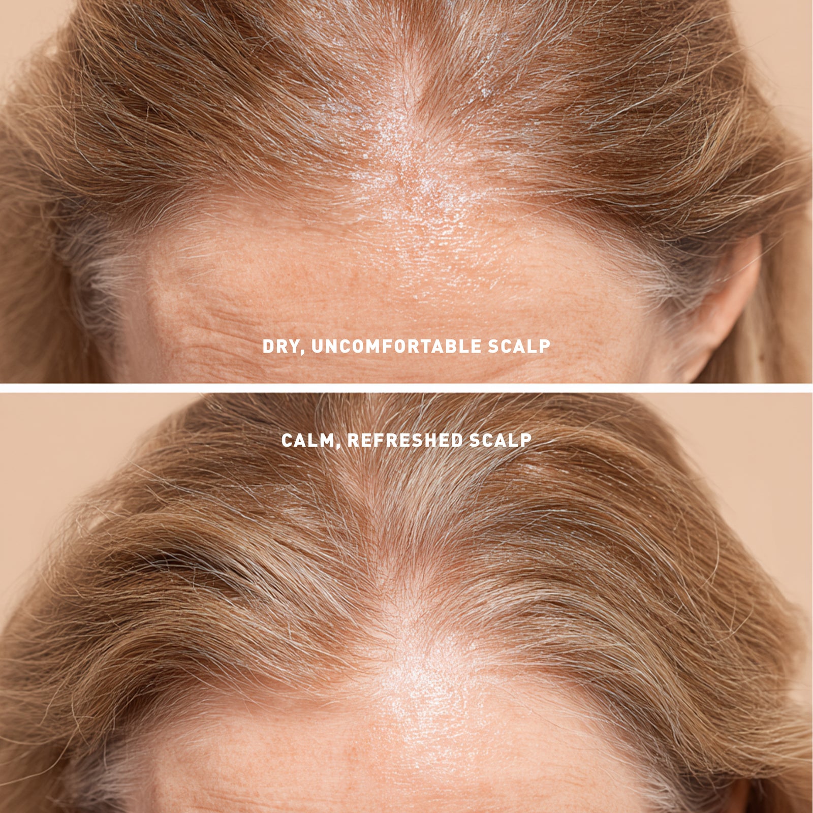 Before and after comparison of a dry, uncomfortable scalp and a calm, refreshed scalp.