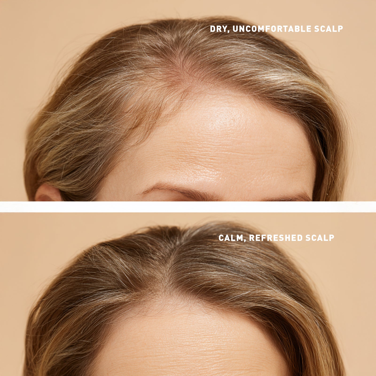 Comparison of a dry, uncomfortable scalp and a calm, refreshed scalp on a beige background.