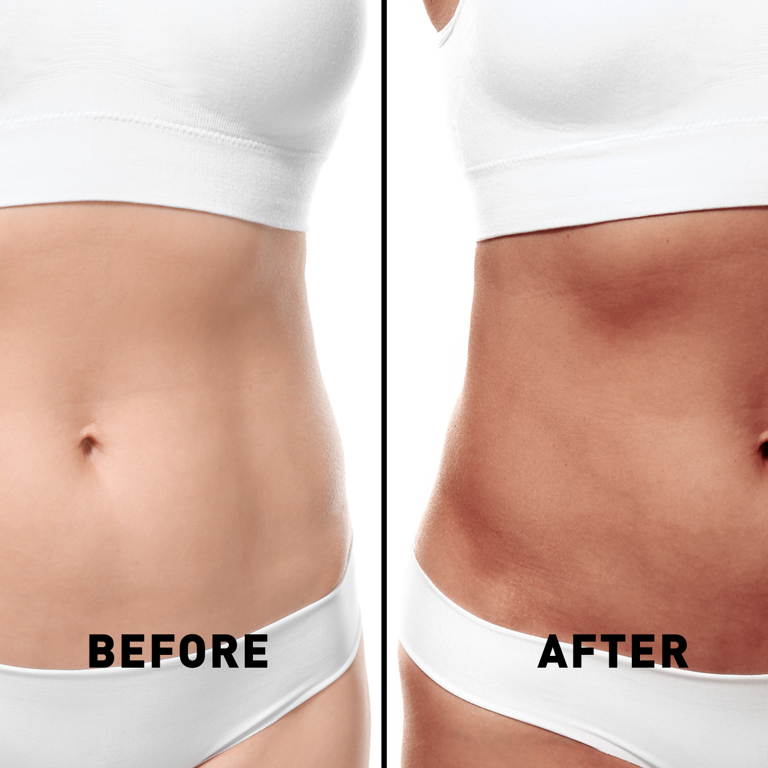 Before and after comparison of a person's waist area wearing white underwear.