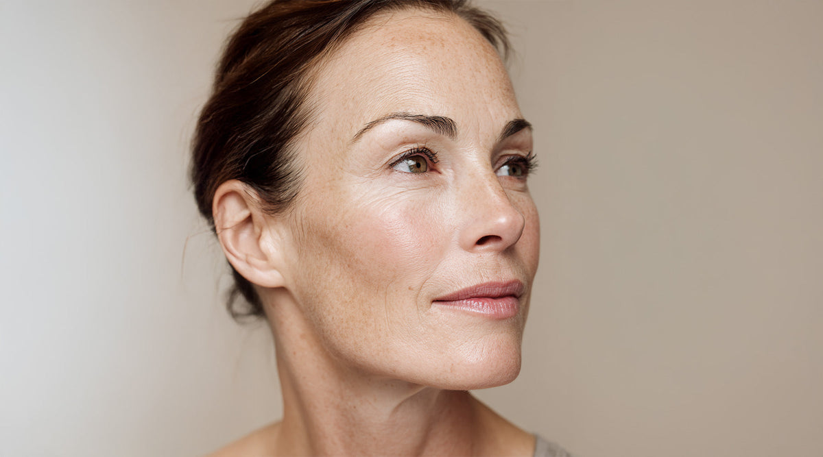 Woman with freckled skin and pulled-back brown hair looking to the side