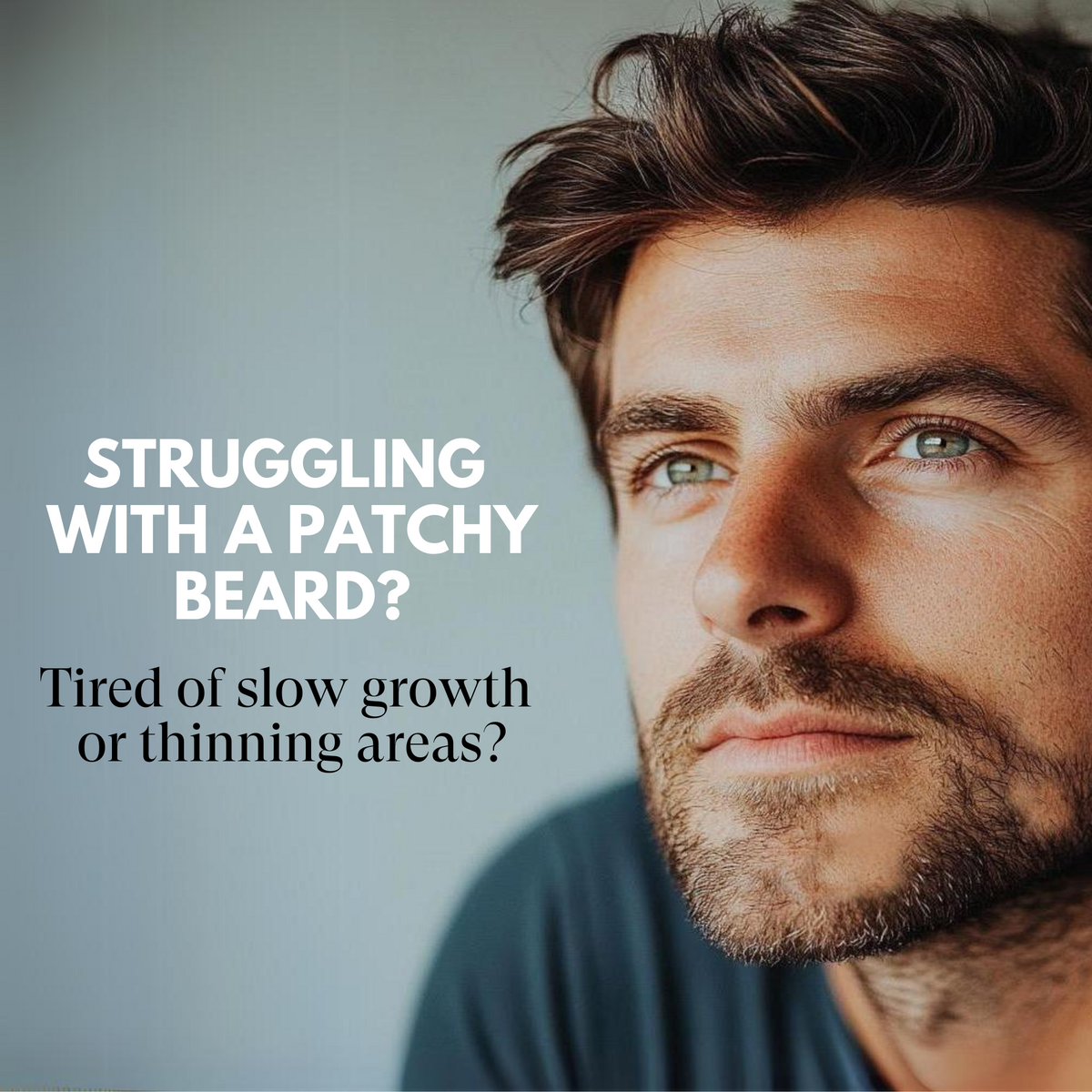 Man with a patchy beard looking directly at the camera with text about patchy beard issues.