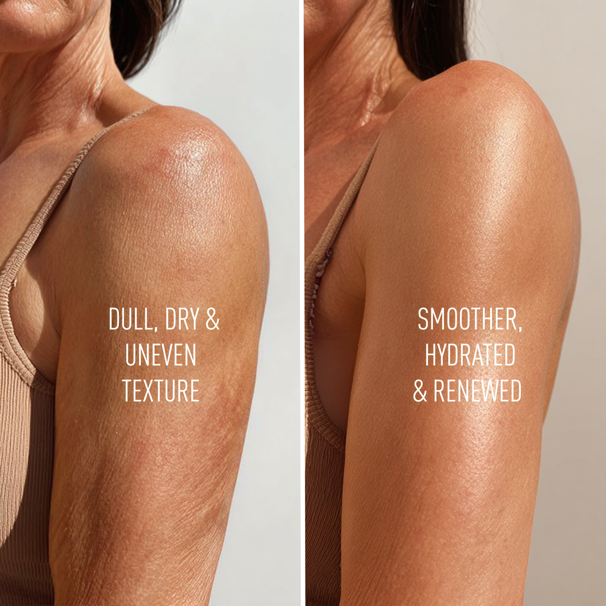 Anti-Aging Body Treatment