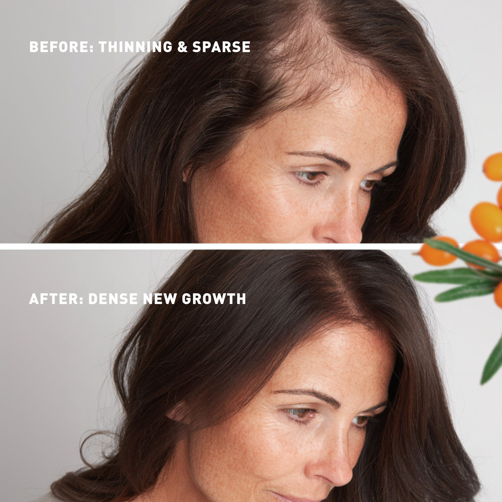 Grow New Hair Treatment | Scalp Problems