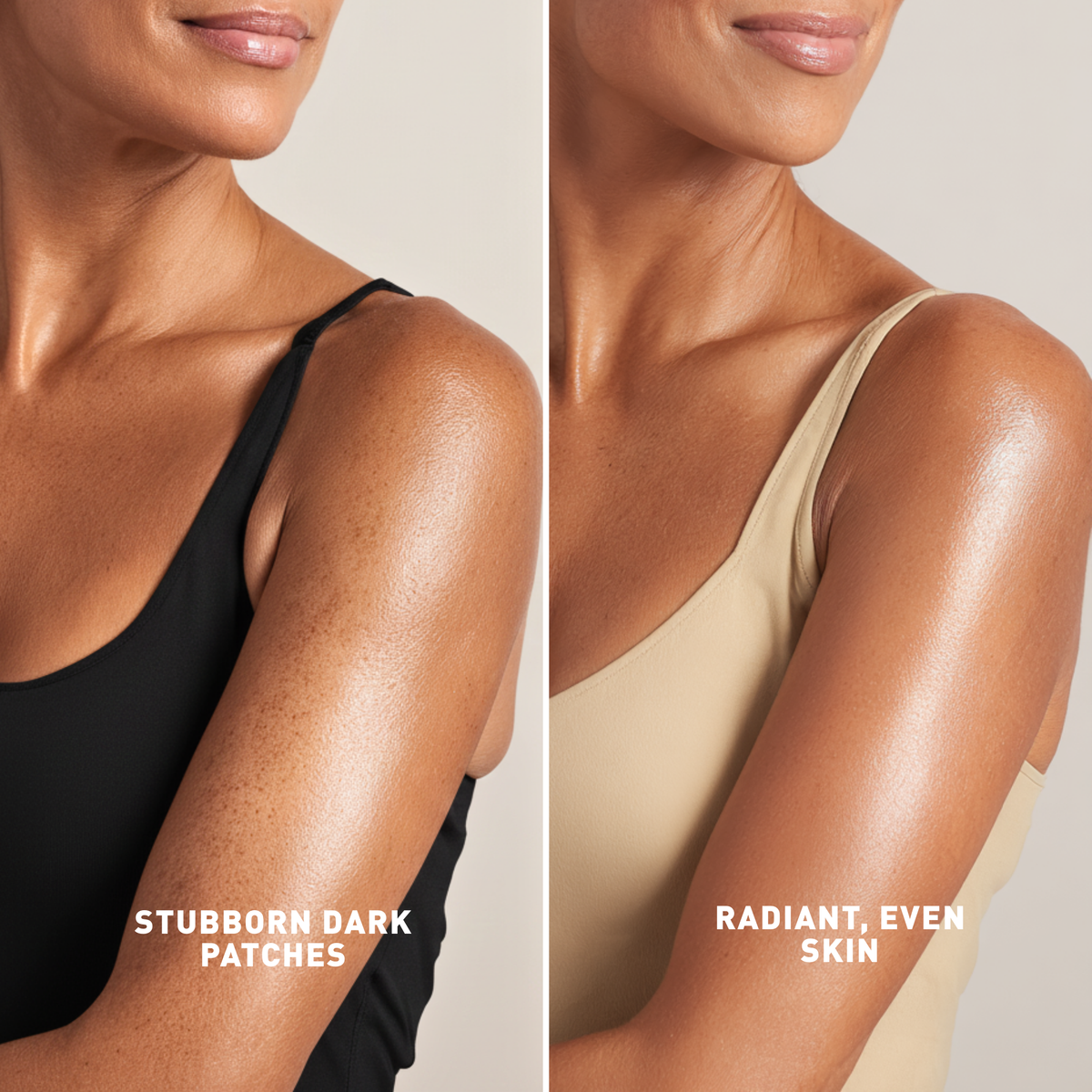Even Skin Tone Treatment | Serums & Oils