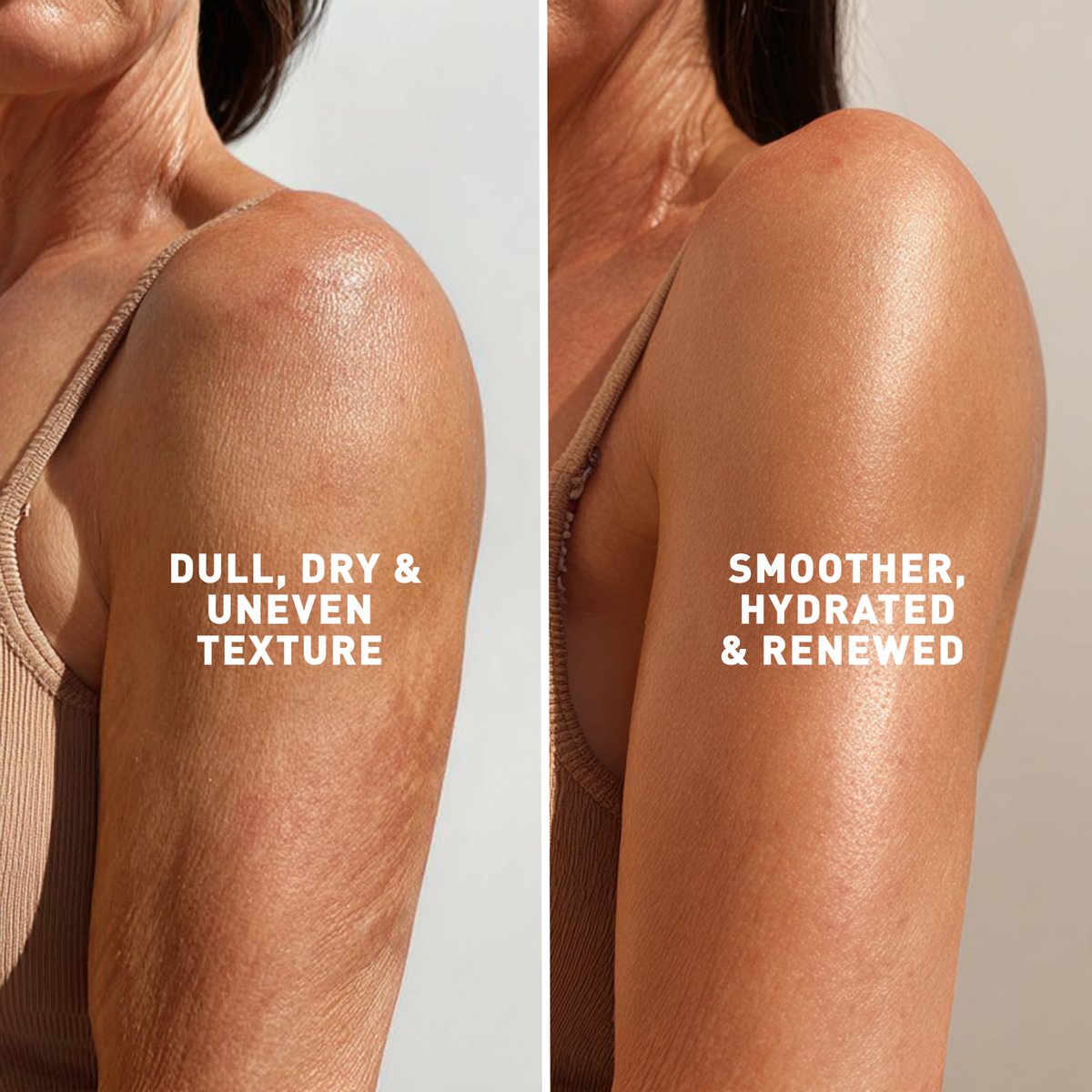 Antioxidant Body Treatment