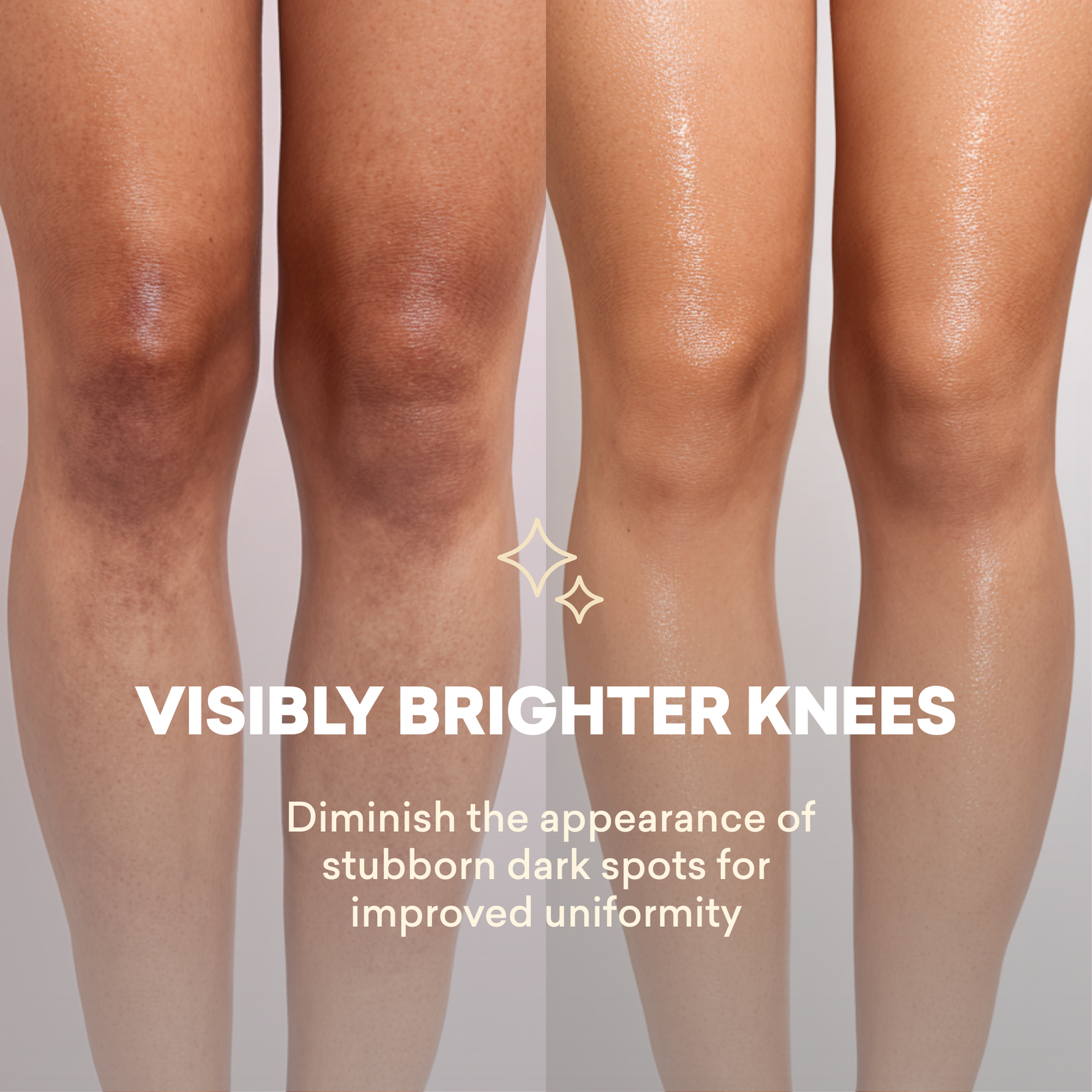 Even Skin Tone Treatment