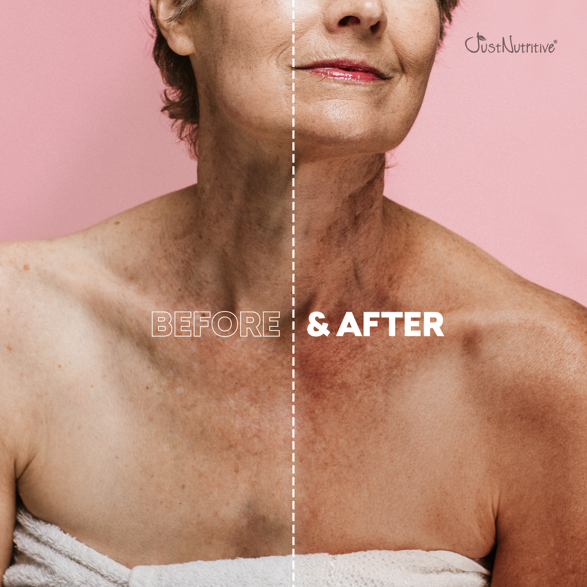 Before and after comparison of a person's neck and shoulders with 'Before' on the left and 'After' on the right, against a pink background.