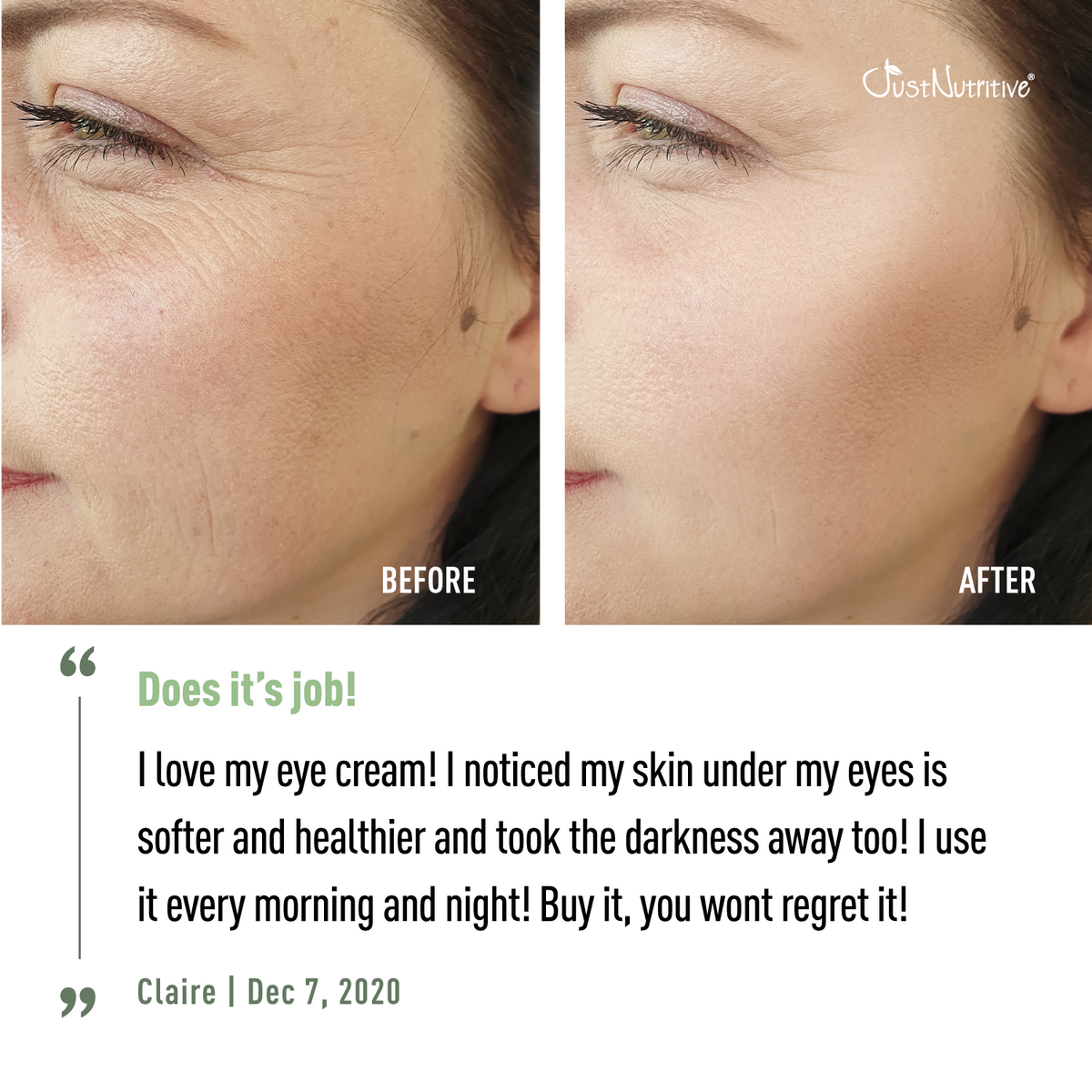 Before and after comparison of eye cream on a woman's face with a visible improvement.