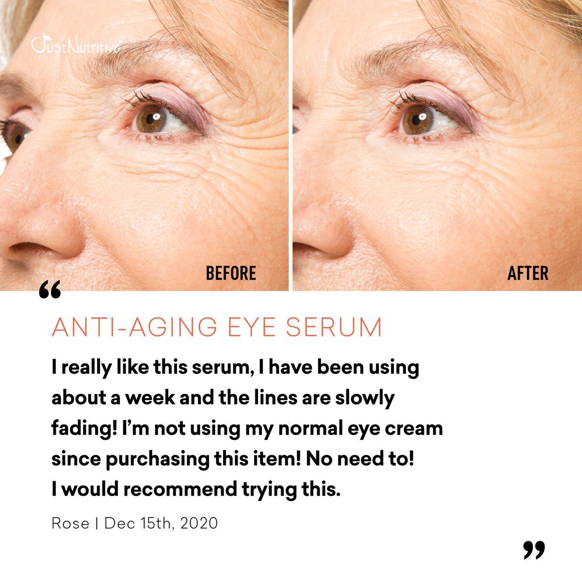 Before and after comparison of a woman's eyes with anti-aging eye serum, featuring a user review.