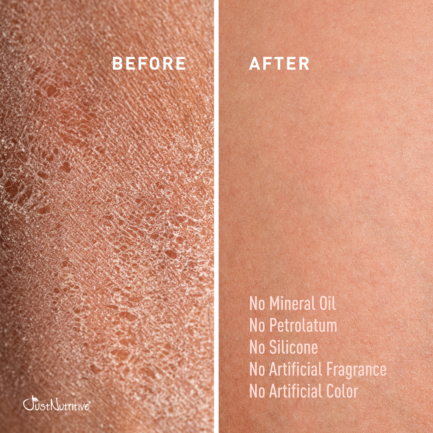 Before and after comparison of skin texture with JustNourish branding.