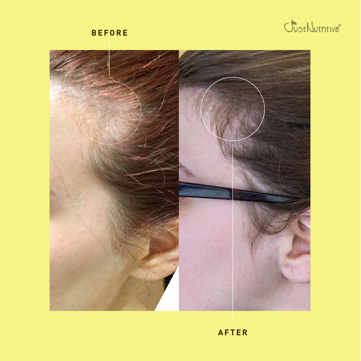 Before and after comparison of hair care product on a person's scalp with 'Just Nutritive' branding.