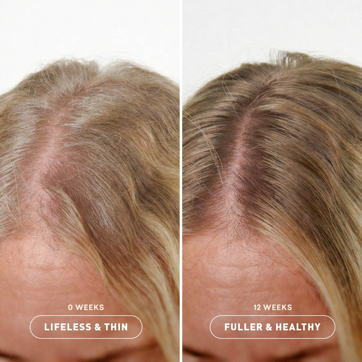 Before and after comparison showing hair with and without build-up center line