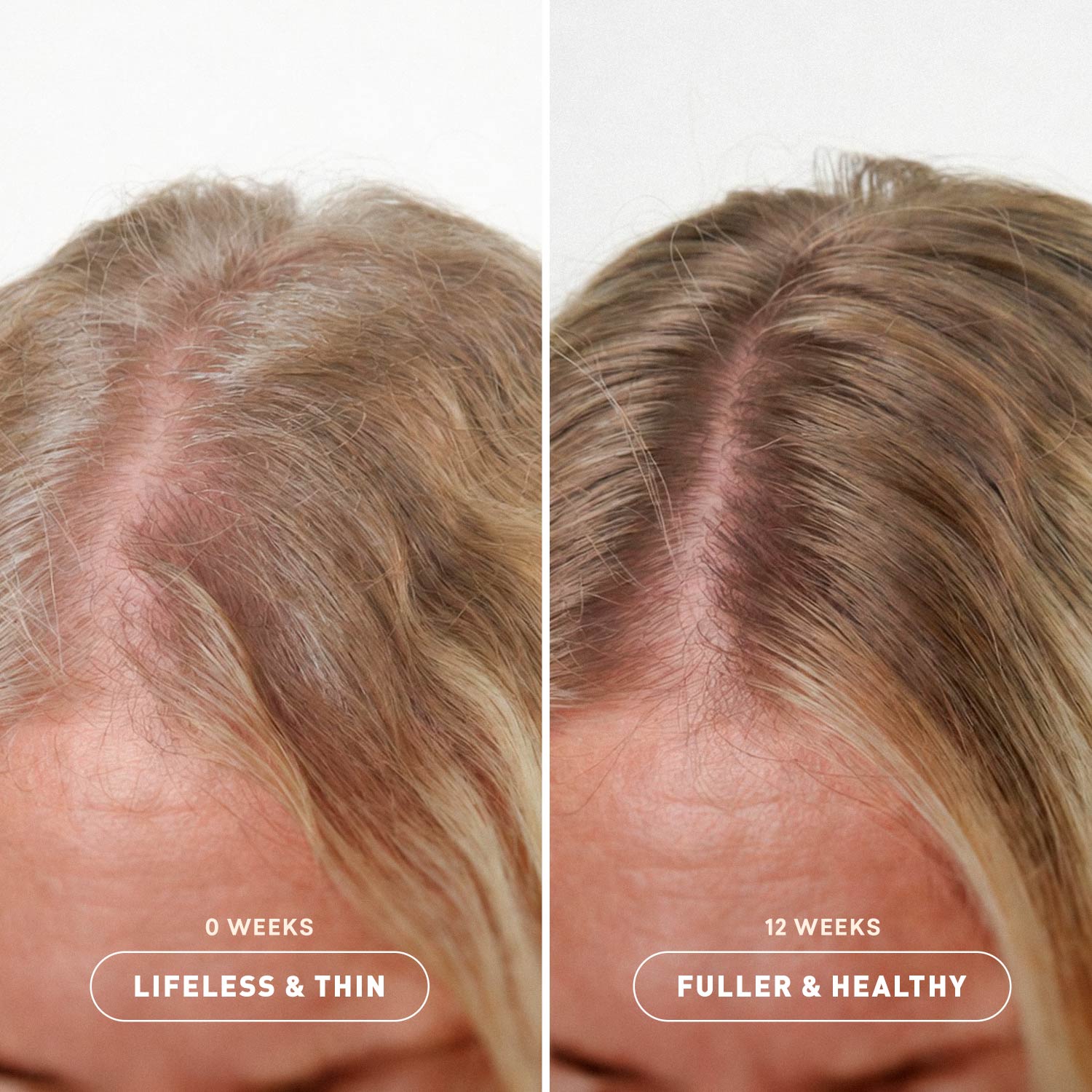 Before and after comparison showing hair with and without build-up center line