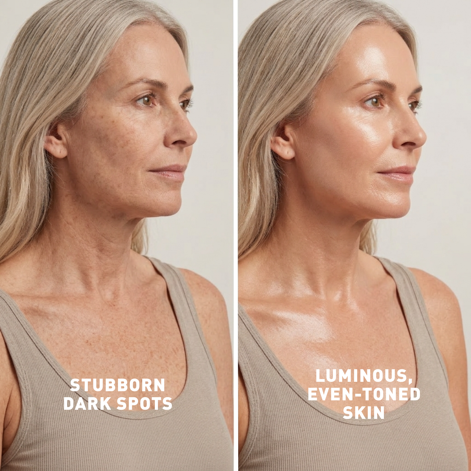 Before and after comparison of a woman's skin with text labels on a neutral background