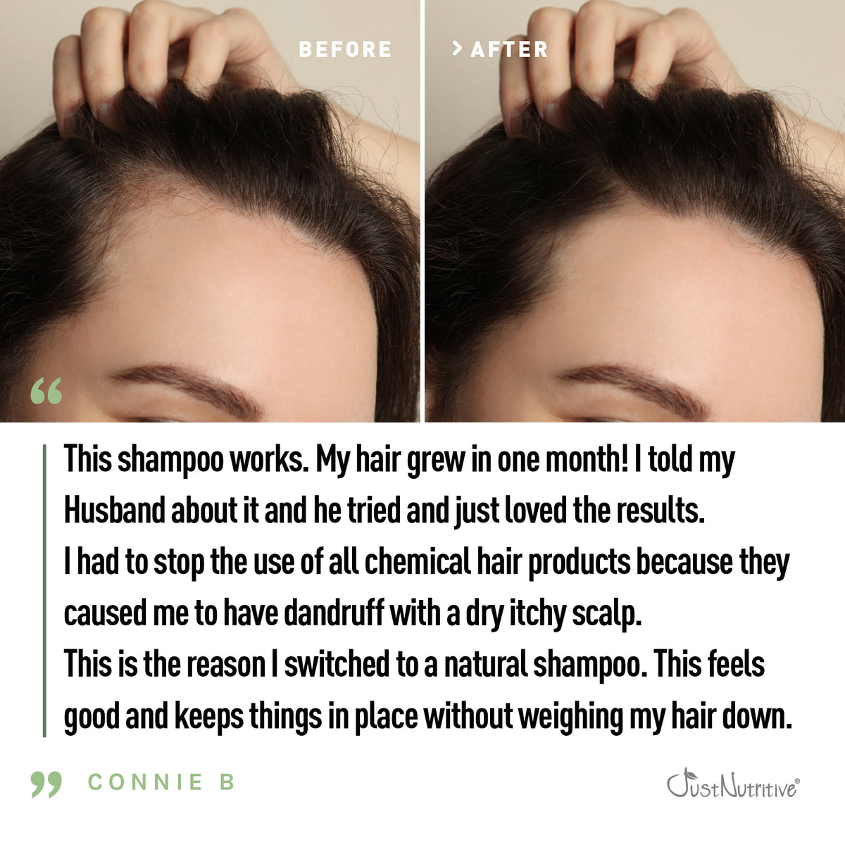 Before and after comparison of hair growth with a testimonial below.