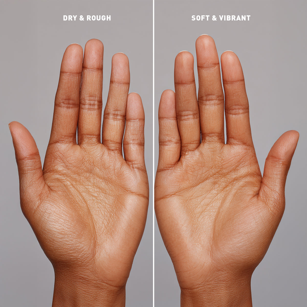 Comparison of dry and rough skin on one hand versus soft and vibrant skin on the other, against a neutral background.