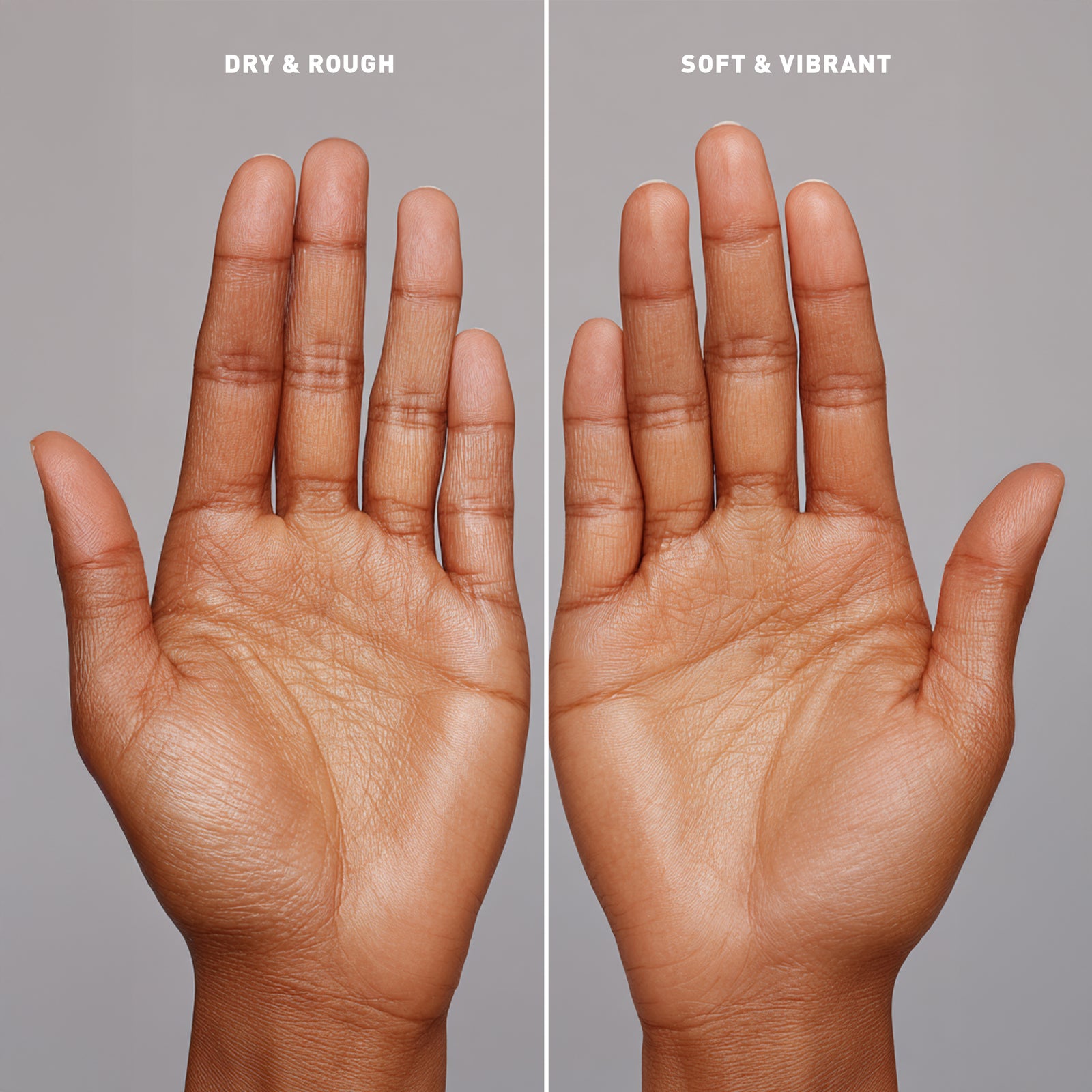 Comparison of dry and rough skin on one hand versus soft and vibrant skin on the other, against a neutral background.
