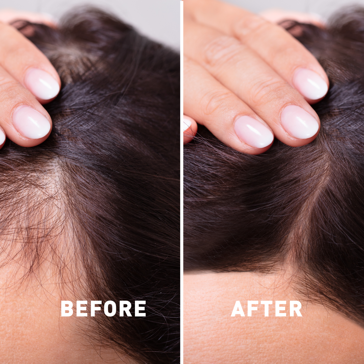 Before and after comparison of hair care product application on scalp