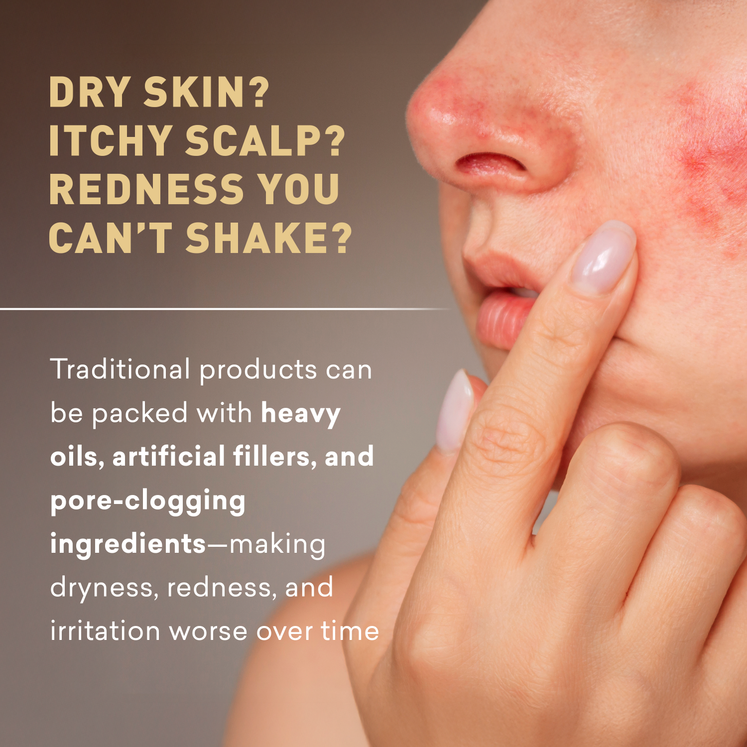 Person with dry skin and redness, text about traditional product ingredients.
