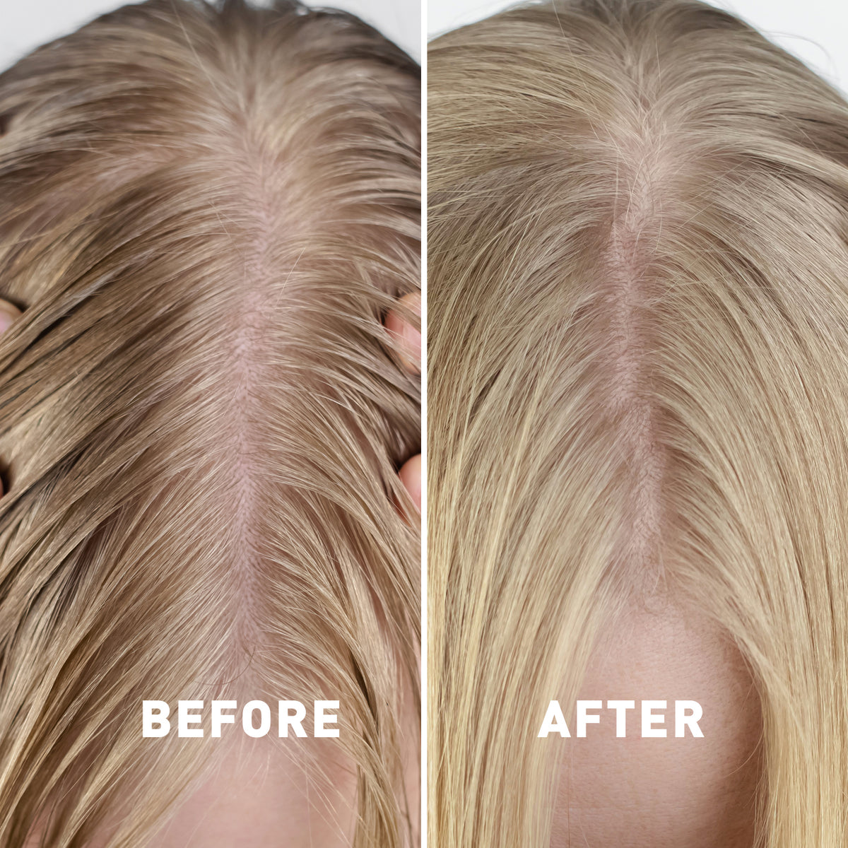 Before and after comparison of hair treatment on a person's head.