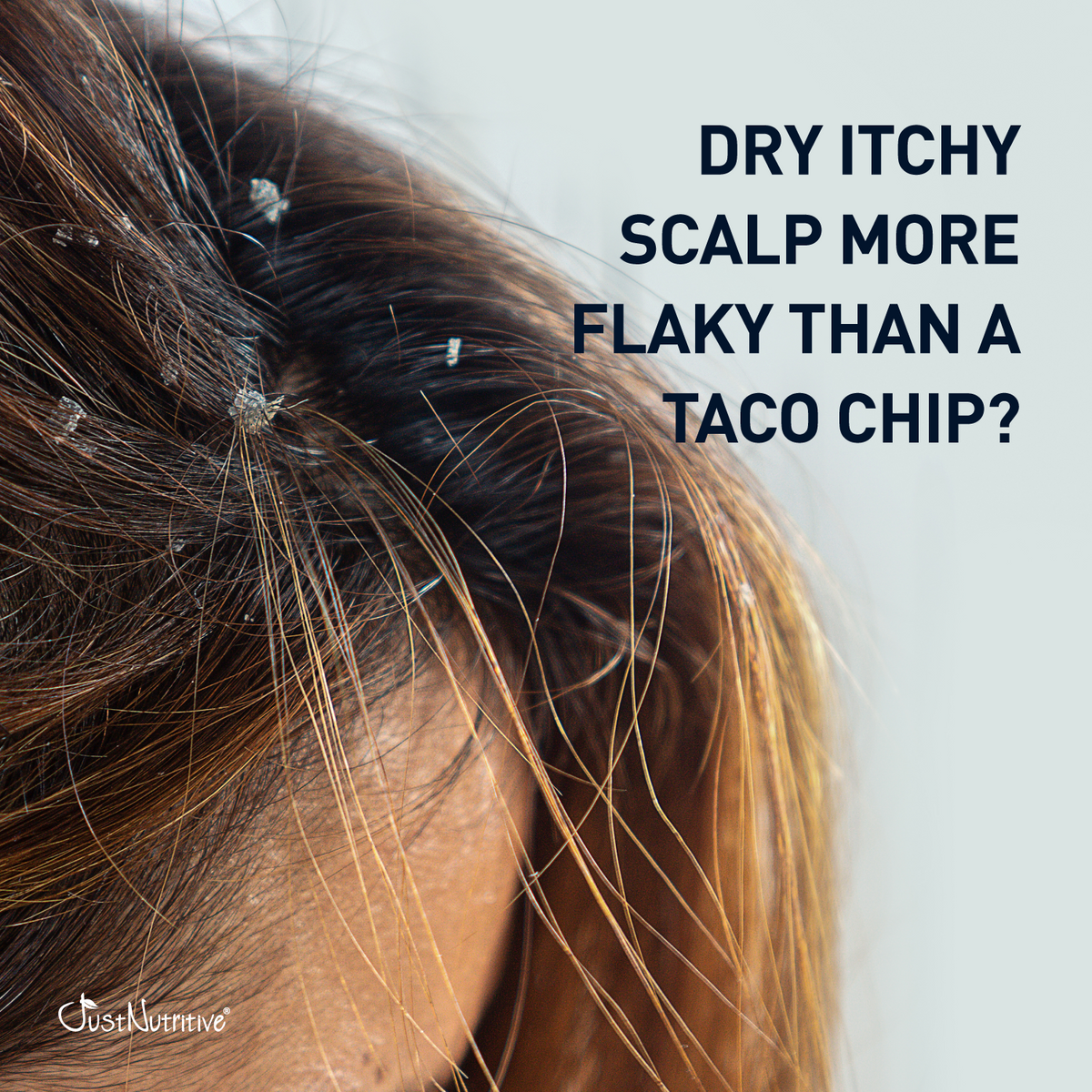 Close-up of dry, itchy scalp with text questioning the severity.