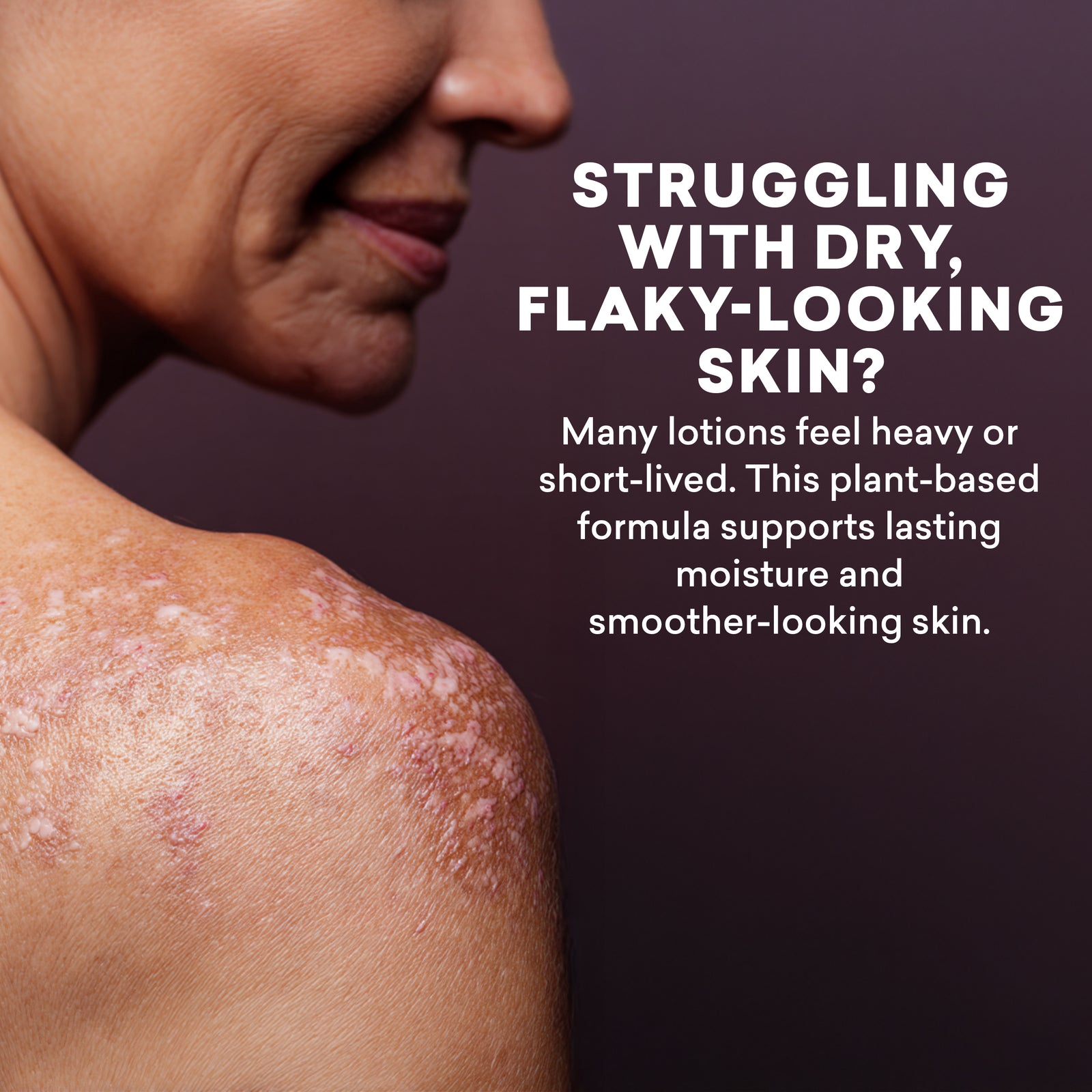 Person with dry, flaky skin on shoulder with text about plant-based skincare solution.
