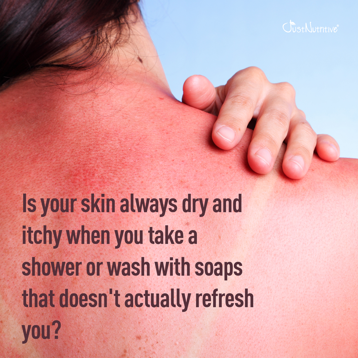 Person with dry, itchy skin holding their shoulder against a blue background