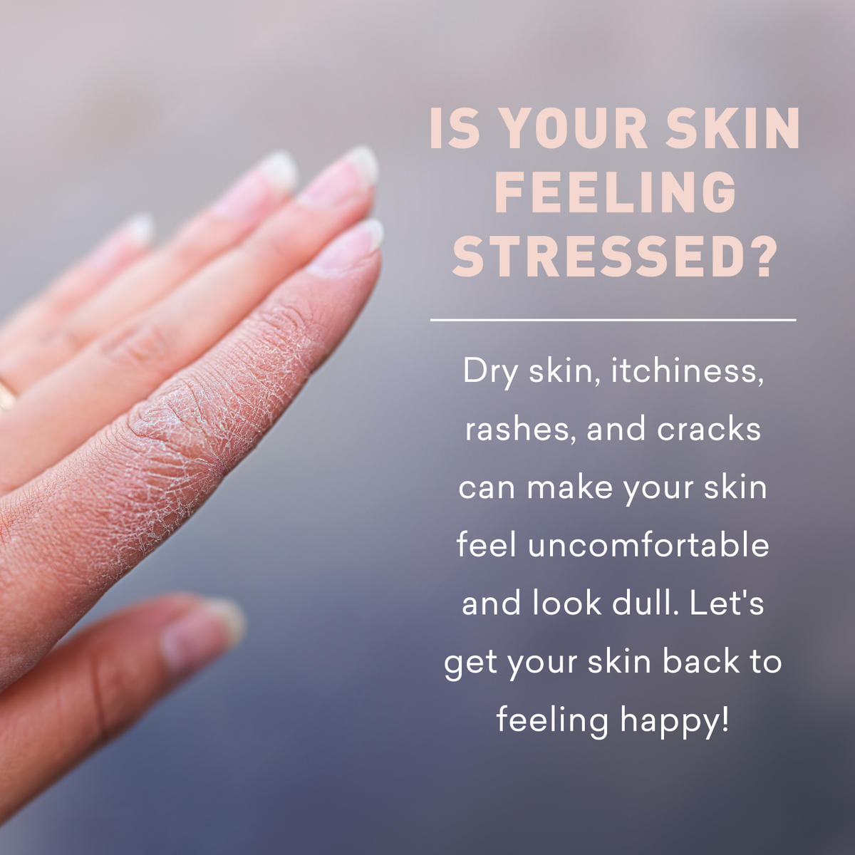 Hand with dry skin on a blurred background with text about skin conditions.