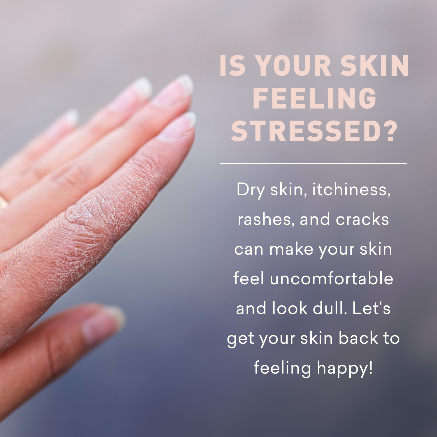 Hand with dry skin on a blurred background with text about skin conditions.