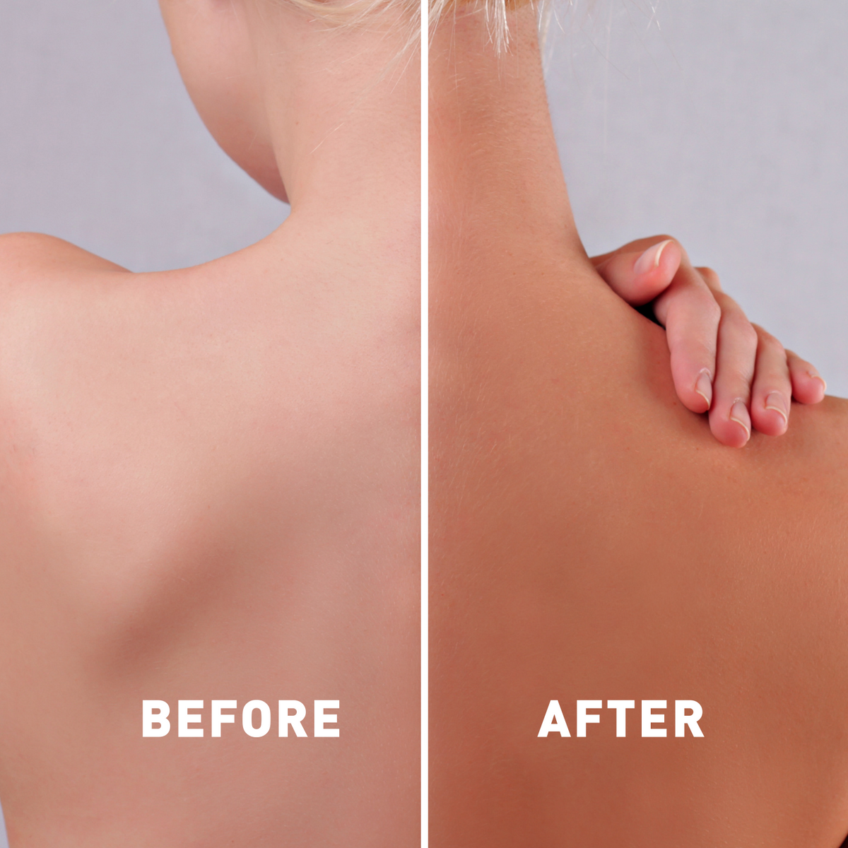 Before and after comparison of a person's shoulder and arm with 'Before' on the left and 'After' on the right.