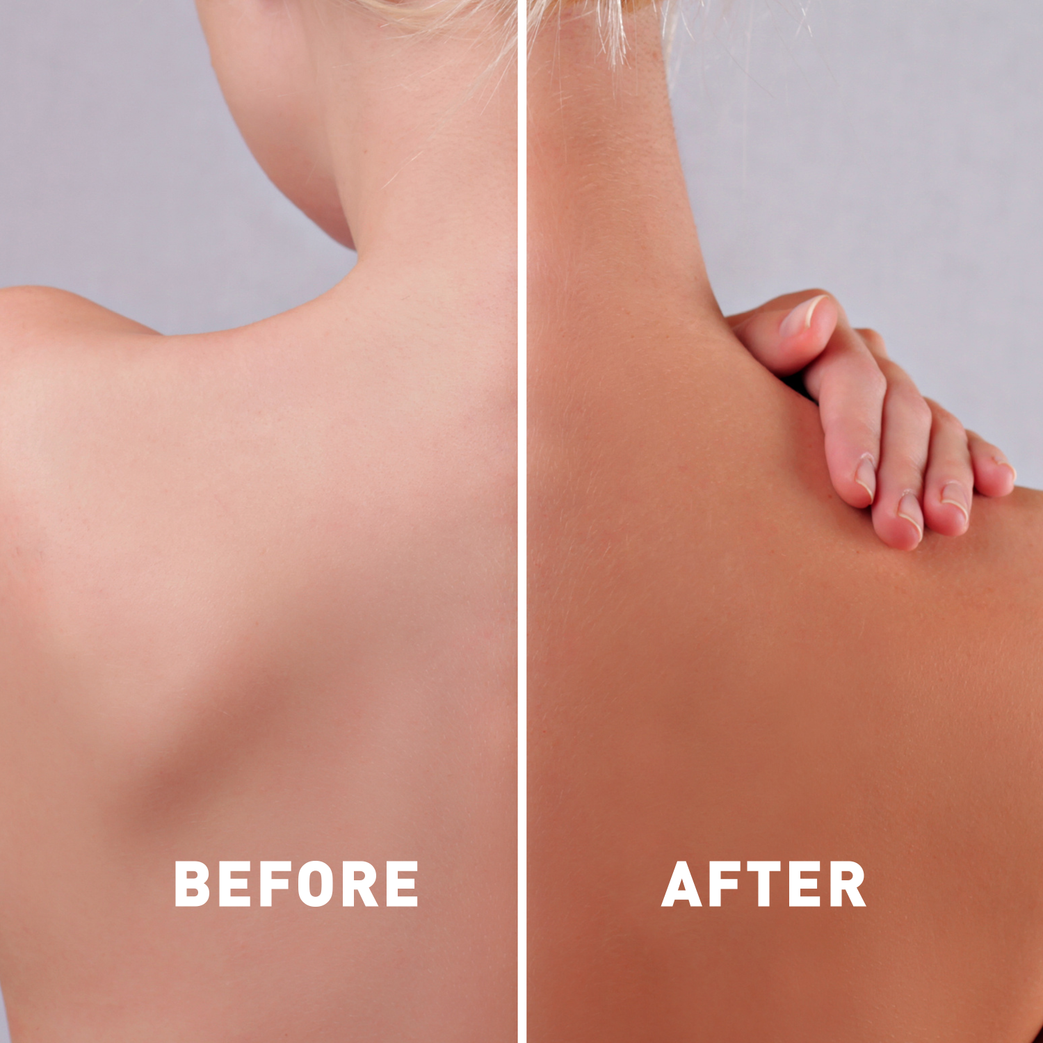 Before and after comparison of a person's shoulder and arm with 'Before' on the left and 'After' on the right.