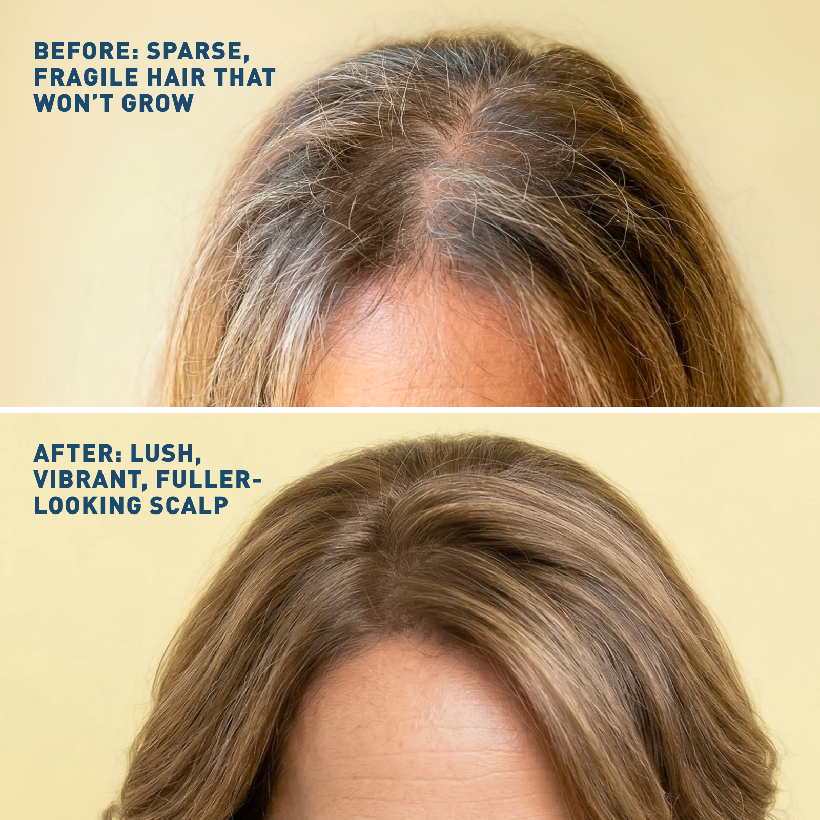 Before and after comparison of a person's scalp with sparse, fragile hair and fuller-looking hair.