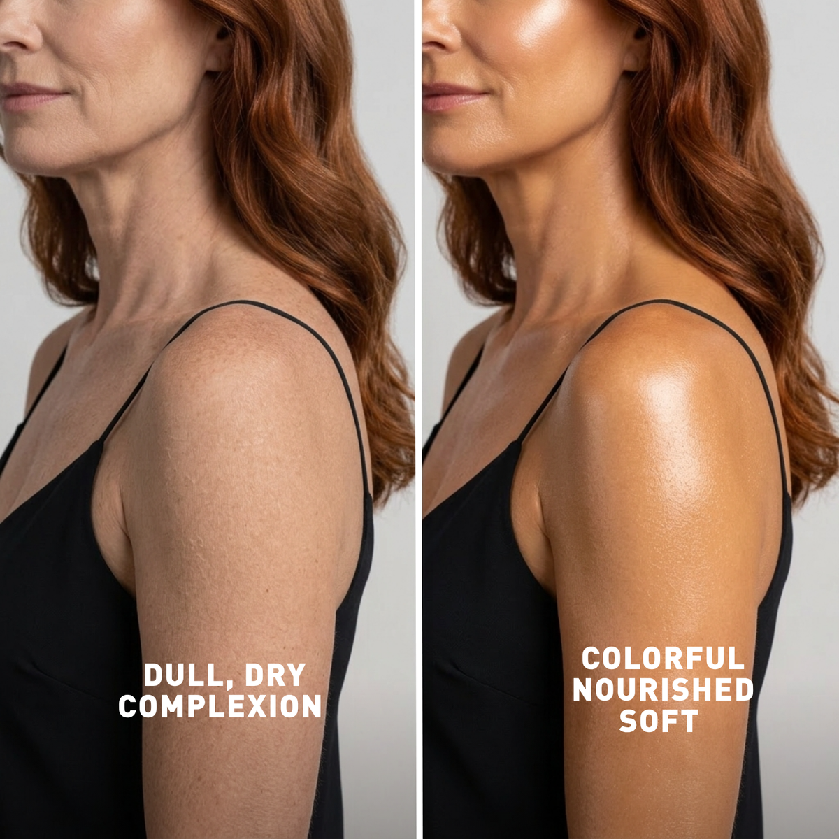 Before and after comparison of a woman's arm with text labels on a neutral background