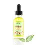 anti-bacterial-acne-treatment-270-146x180.jpg