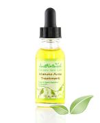 manuka-acne-treatment-270-146x180.jpg