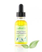 natural-night-acne-treatment-270-2-146x180.jpg